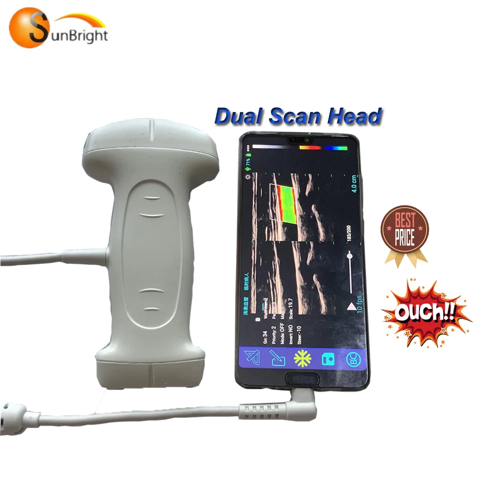 

SUN-D3 portable USB dual linear and convex probe ecografo portatil color doppler ultrasound