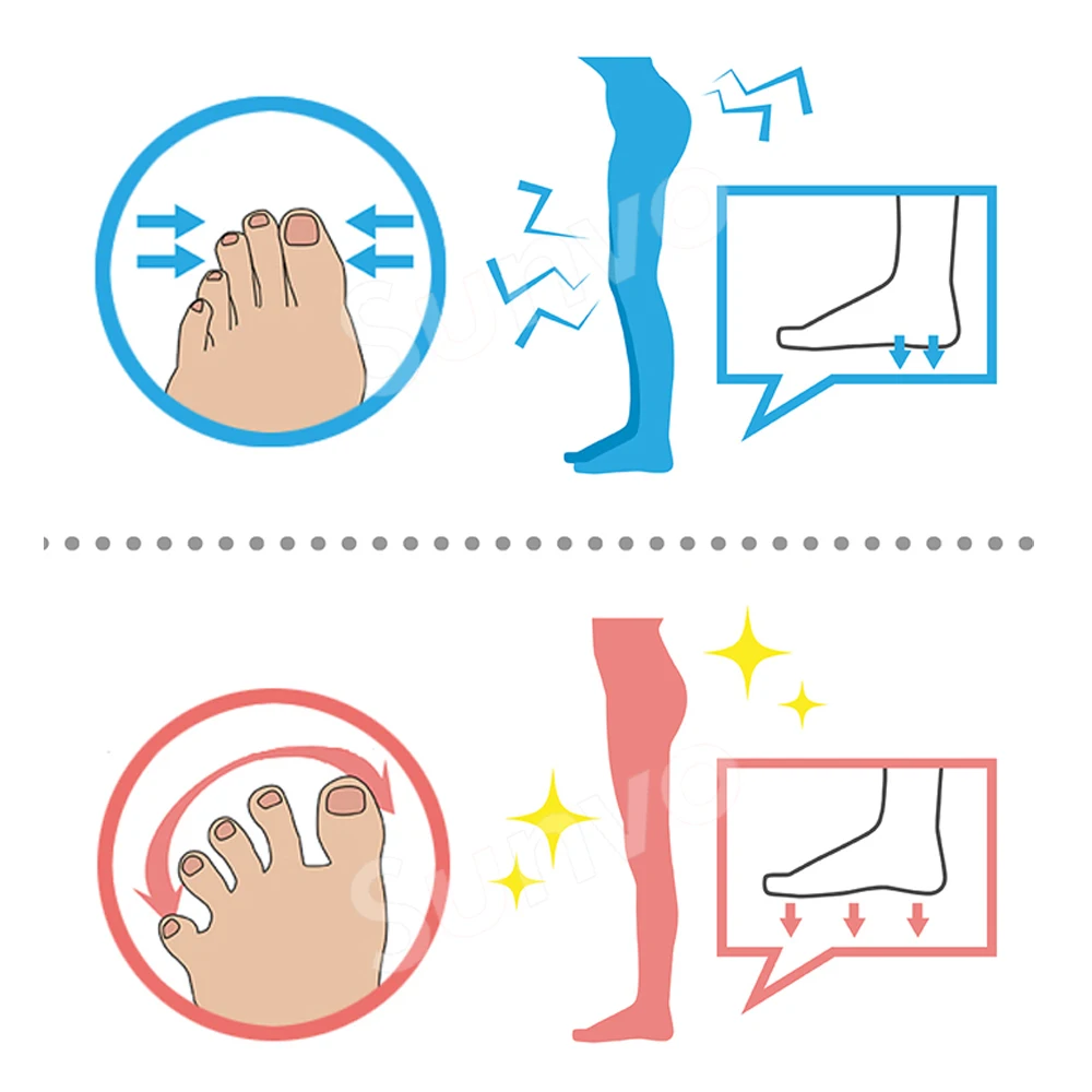 Sunvo Hallux Valgus Orthotics Bunion Splint for Separate All Toe Big Bone Orthopedic Foot Hammer Corrector Separator Inserts Pad