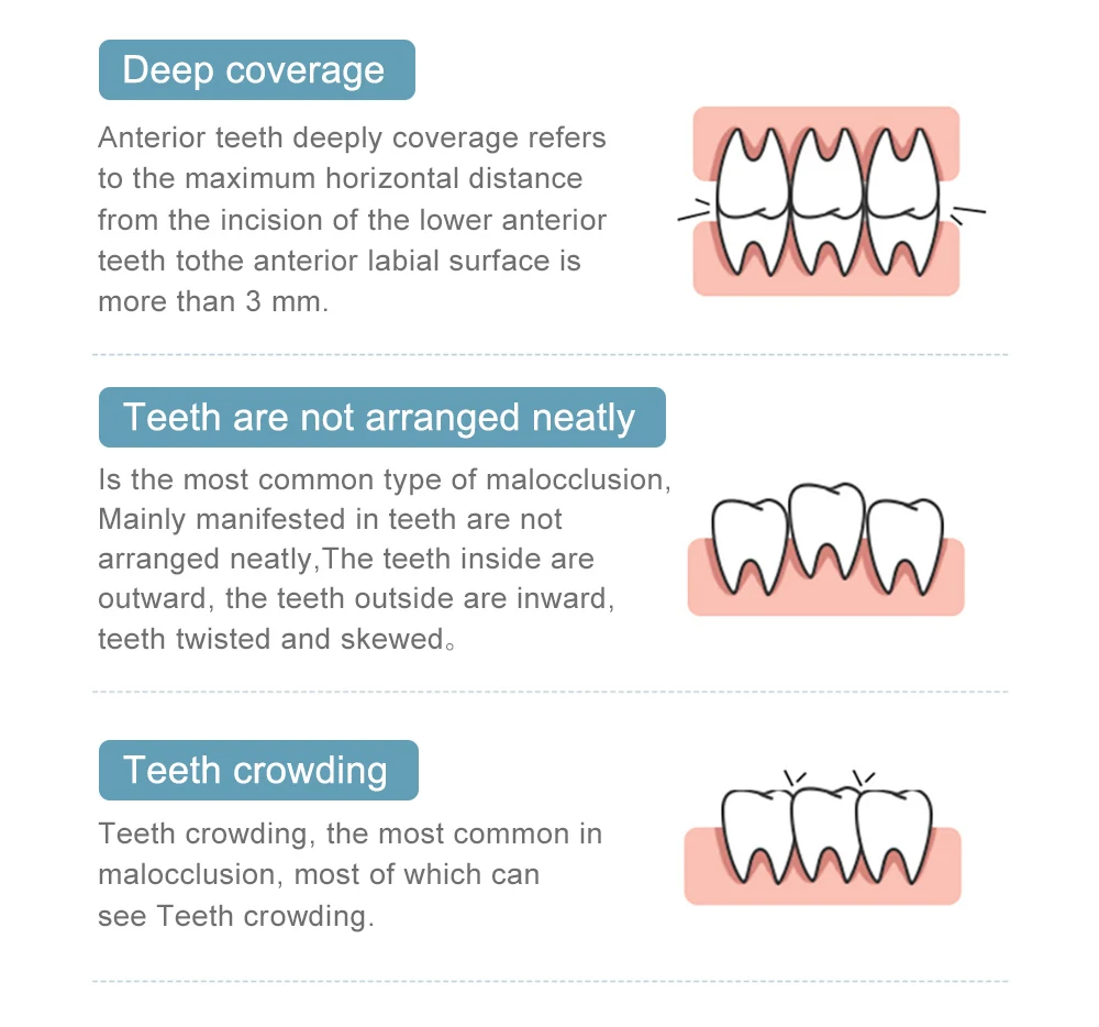 Cofoe Dental Braces Orthodontic locator Invisible orthodontic bracket For Smile Teeth Alignment Trainer and dental care With box