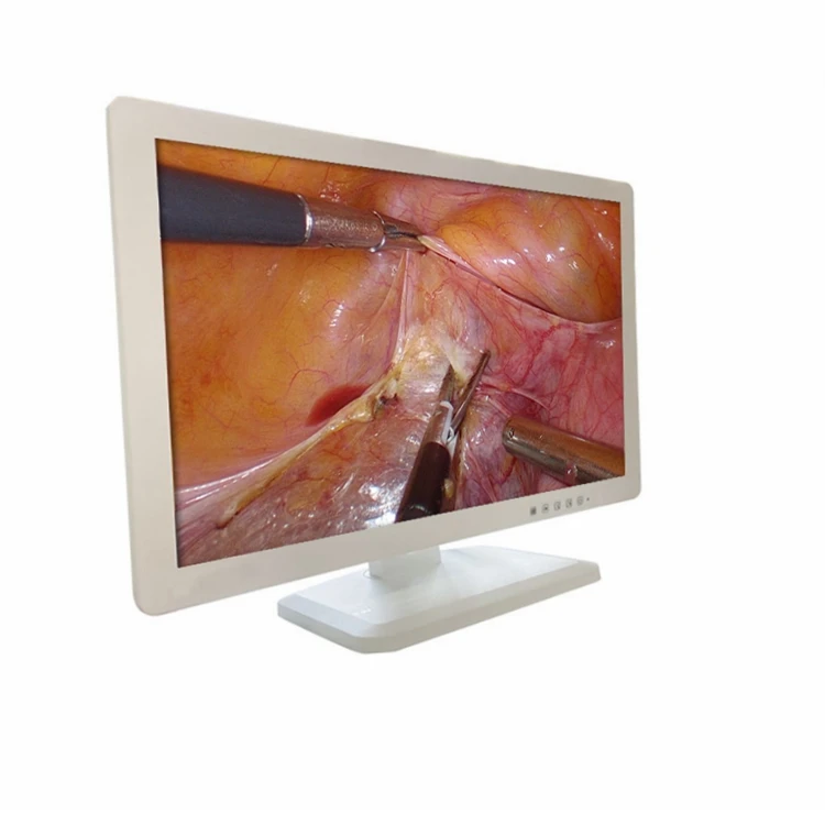 

27 inch Endoscopic medical monitor lcd screen for hysteroscopy arthroscopy urology anorectal