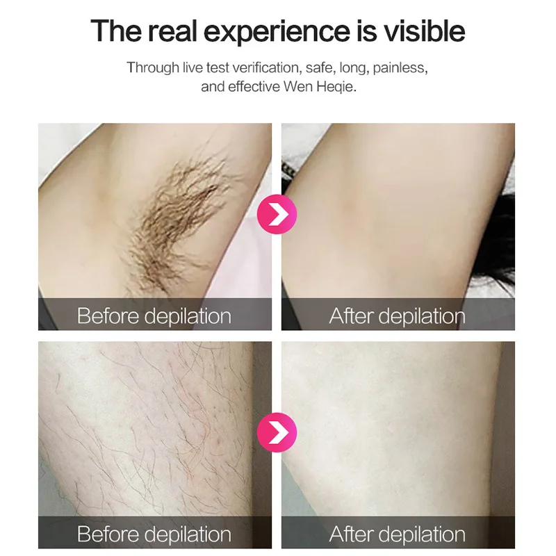 Безболезненный ipl лазер для удаления волос Домашний косметический инструмент