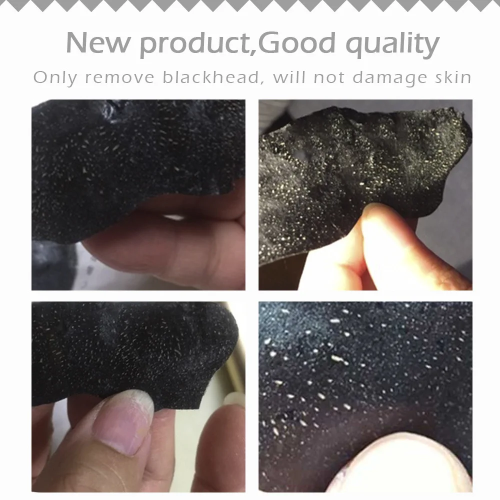 Горячая Распродажа маска для удаления угрей в носу очиститель пор лечение акне