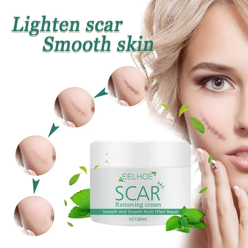 

Scar cream to scald burn scars, old scars, acne, pit scars, postoperative scars, and skin smoothing and repair cream