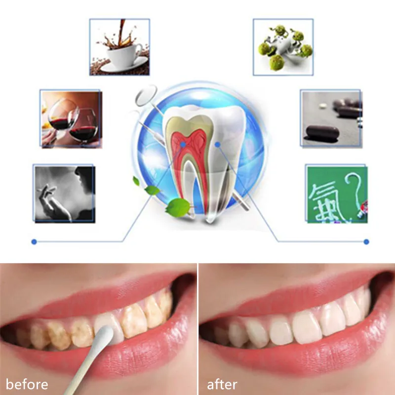 

10ml Teeth Whitening Water Oral Hygiene Cleaning Teeth Care Tooth Cleaning Whitening Water Clareamen to Dental Odontologia