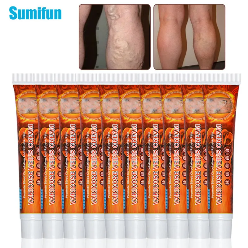 

10pcs Sumifun Varicose Veins Ointment Medical Plaster Skin Care Treatment Vasculitis Phlebitis Spider Varicosity Angiitis Creams