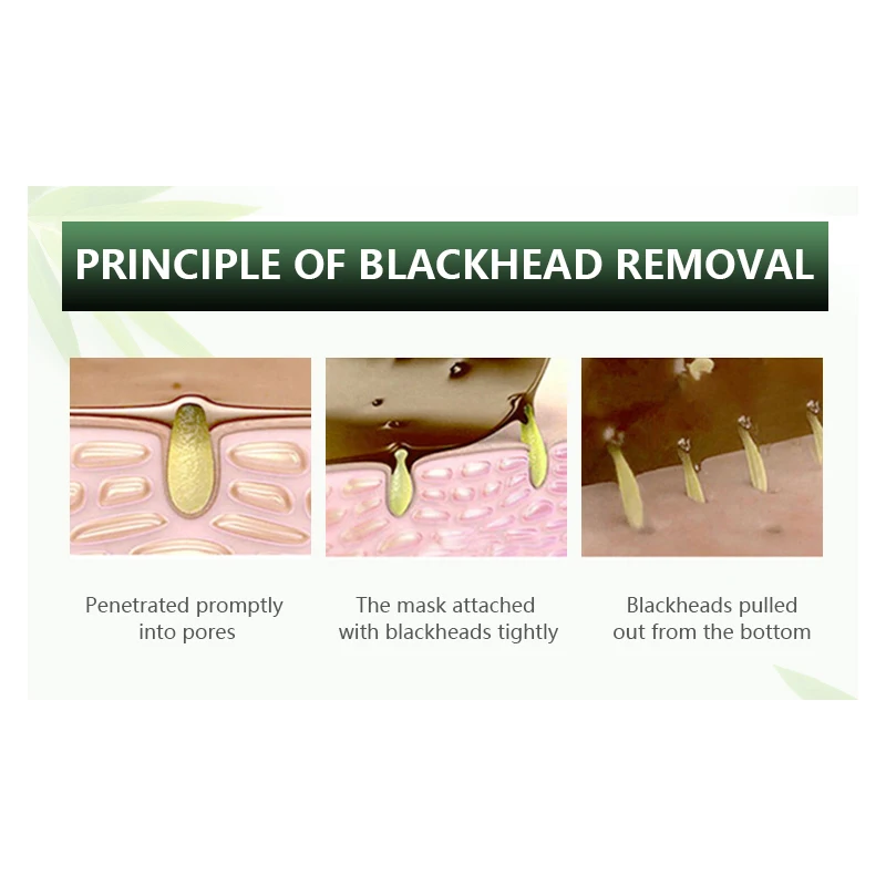 AuQuest Blackhead Exporting Liquid Derivatives Refined Pore Serum Softening Cutin Remove Acne Spot Face Care TSLM1 |