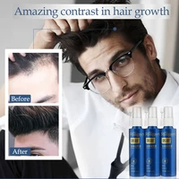 3pcs hair growth oil essence thickener for hair growth serum hair loss product 100 natural extract liquid oil fast hair growth