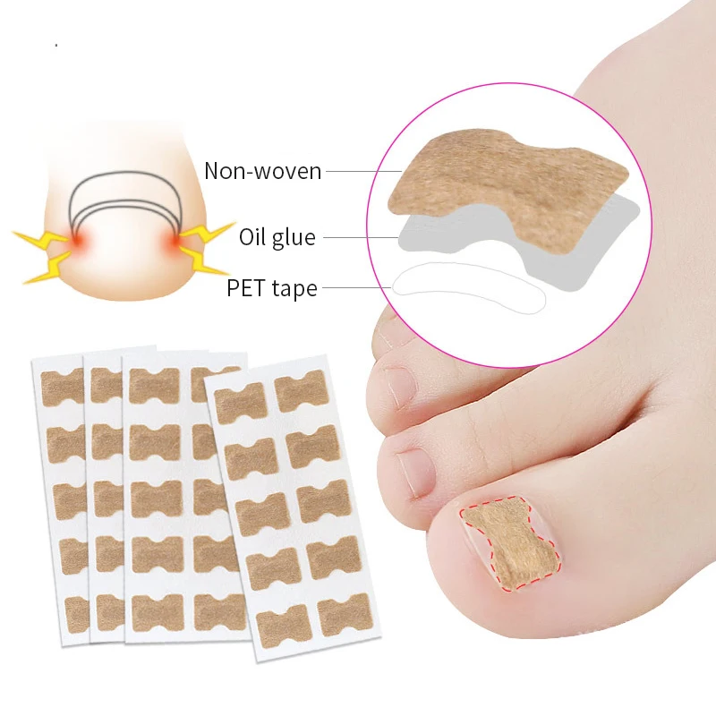 1-5Sheet Nail Ingrown Correction Sticker Treatment Paronychia Correction Pedicure Elastic Force Sticker Pedicure Foot Care Tool