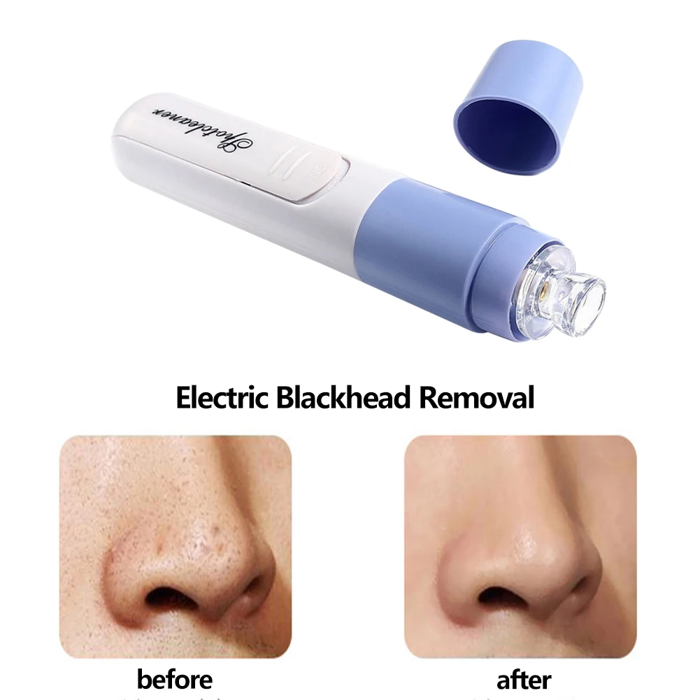 

Mini Portable Blackhead Remover Vacuum Pore Cleaner Electric Nose Face Deep Cleansing Skin Care Machine Beauty Tool