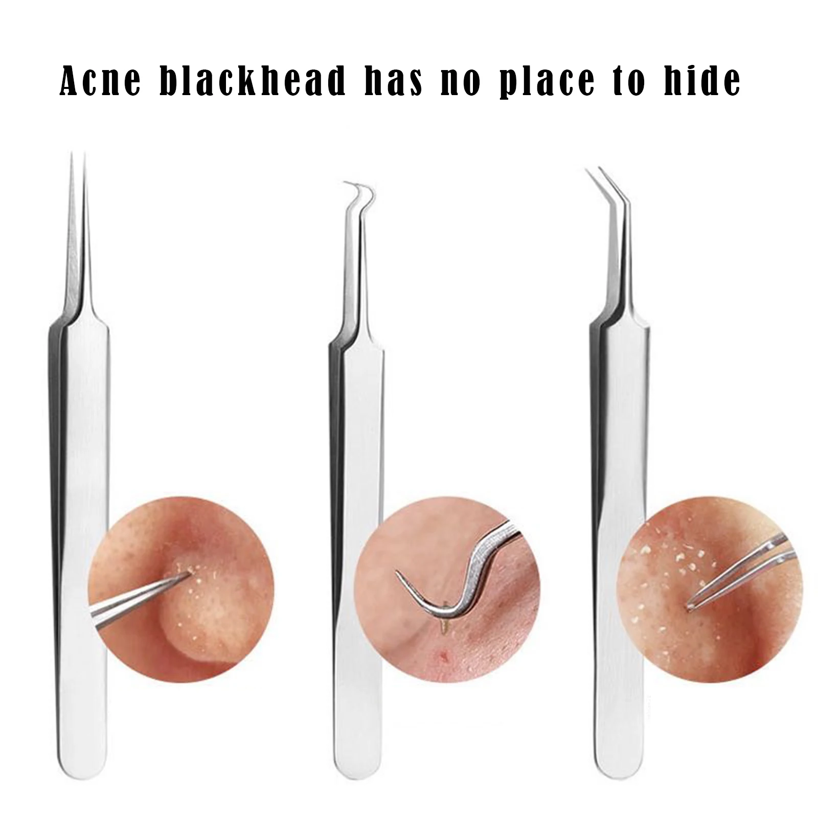 Новинка Лидер продаж Blackhead Clip пинцет с иглами экстрактор для прыщей жидкость