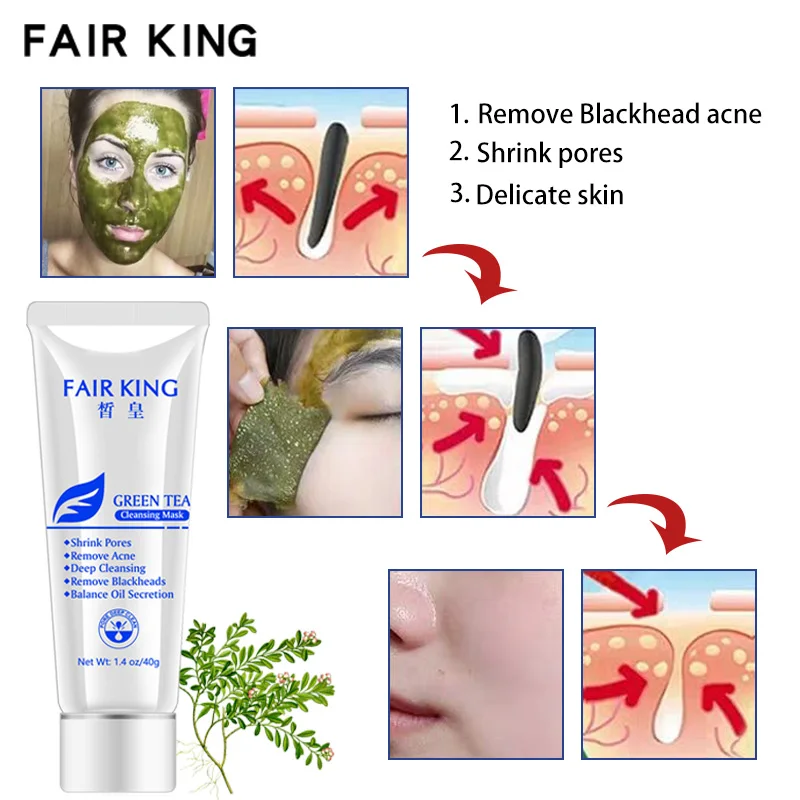 Средство для удаления черных точек с зеленым чаем средство лечения акне грязевая