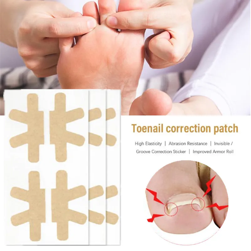 

5 Sheet/Set Ingrown Toenail Corrector Stickers Orthodontic Paronychia Treatment Recover Patches Toe Fingernail Foot Care Tool