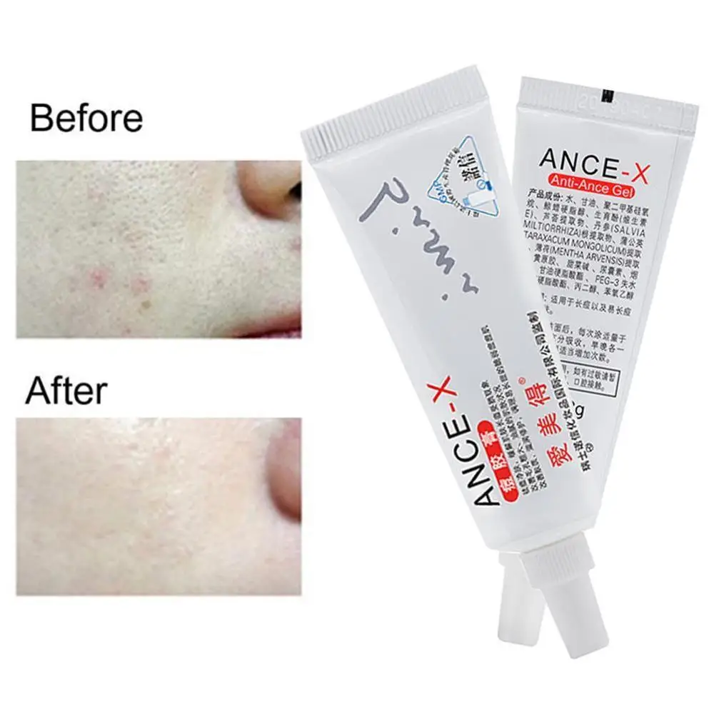 15 г лечение шрамов крем для лица акне на лице шрам средство удаления растяжек