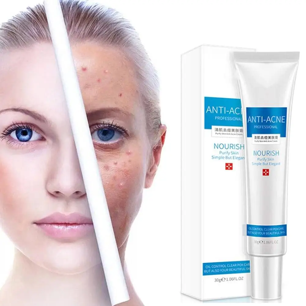 30g анти акне крем очистить очищенную кожу не раздражает увлажняющий поры и черных