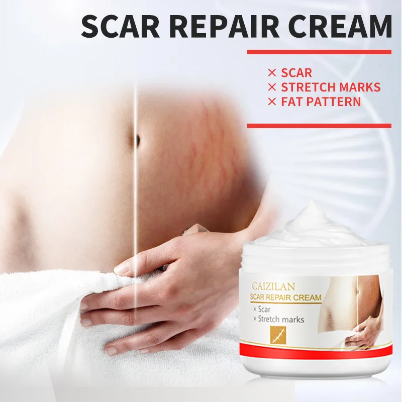 

Scar Removal Cream Acne Scars Gel Stretch Marks Surgical Scar Burn for Body Pigmentation Corrector Acne Spots Repair Care 30g