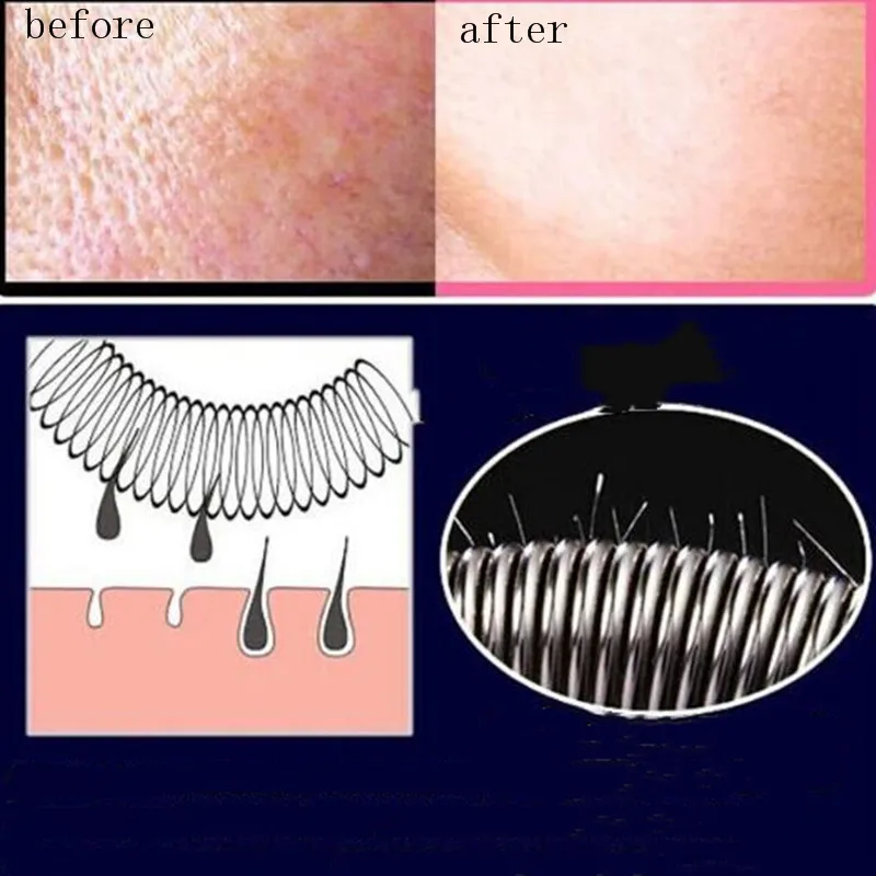 Уход за лицом уход волосами кожей лица волос курица выщипывание устройства