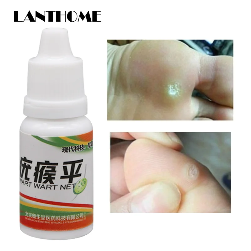 Black Dots Mole Wart Skin Tag Remover 12 Hours Tu Kill Liquid Medical Foot Corn Removal Care Solution |
