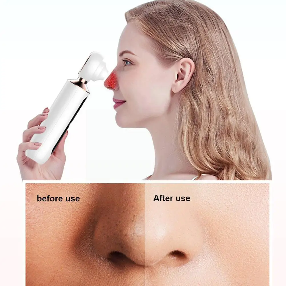 

Visual Blackhead Meter Household Pore Cleaner Blue Meter Light Face Washing Sucking Cleansing And Electric New Blackhead X8Y2