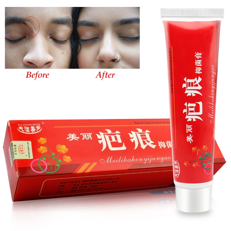 Крем для удаления шрамов от акне рубцов гель растяжек хирургический корректор