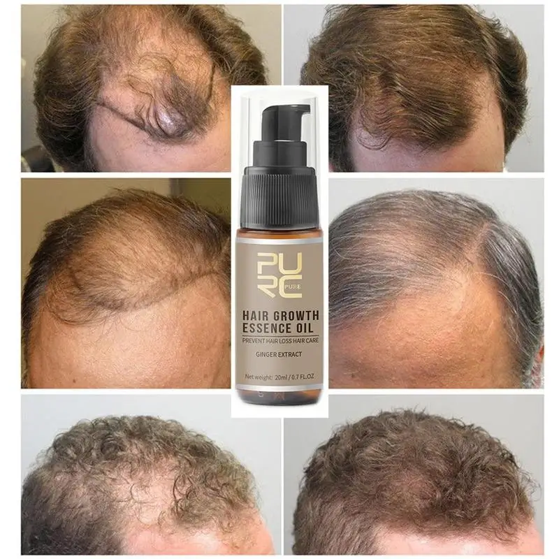 

20ml Fast Growth Hair Essence Essential Oil Liquid Essence Hair Treatment Hair Preventing Oil Grwoth Spray and Hair Loss Ca H7T9