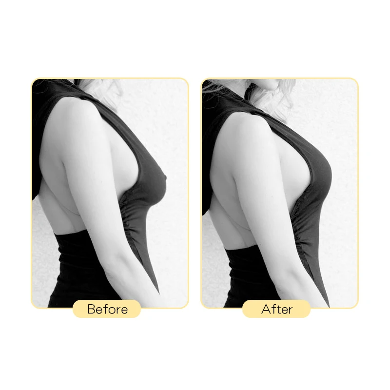 Pure Color Invisible Rabbit Ears Shaped Strapless Silicone Bra Cover Sexy Non-slip Anti-bump Point Reusable Pictorial Sticker | Женская