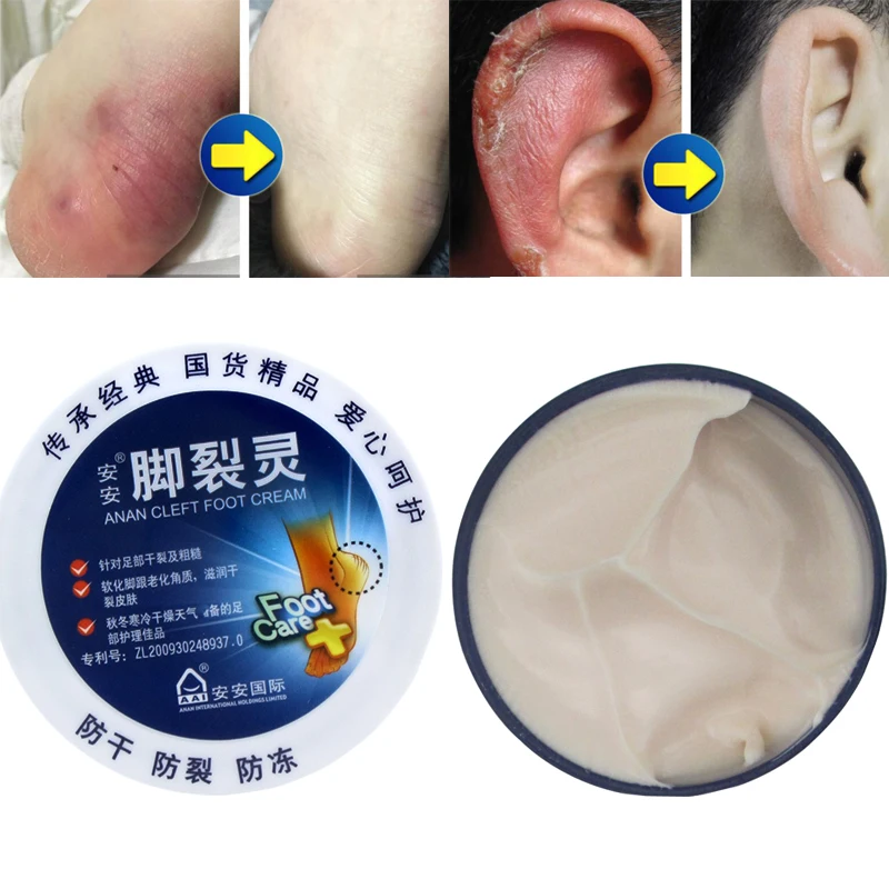 

Традиционный китайский отшелушивающий крем-бальзам для сухой кожи пяток