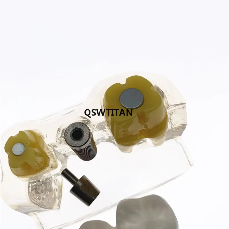 Прозрачная модель зубных протезов для анализа имплантатов короны