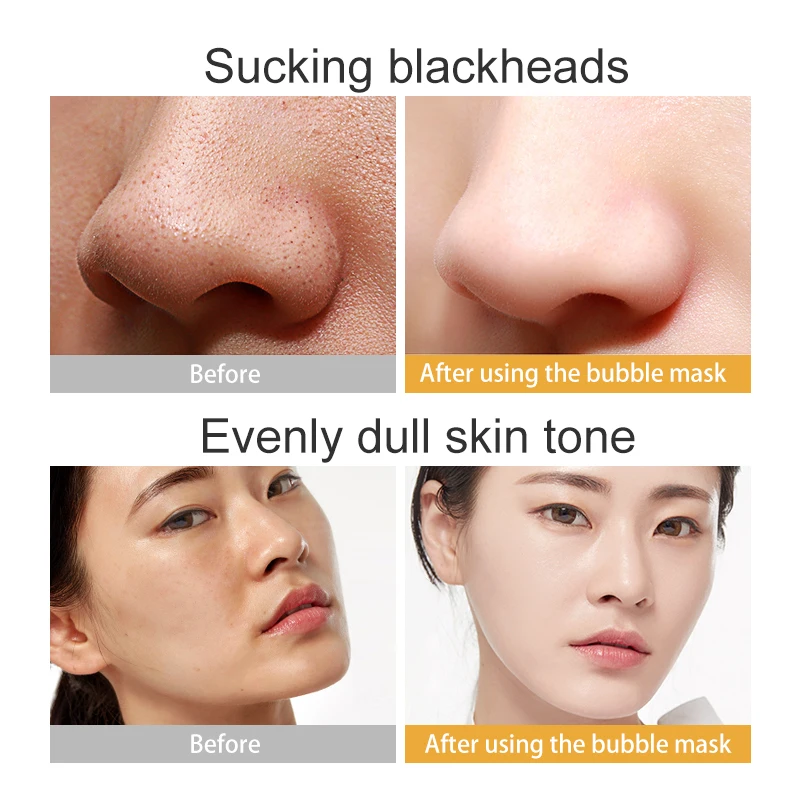 

10pcs Fonce Beer Yeast Oxygen Bubble Mask 10 Piece Sticking Moisturizing Deep Cleansing Brightening Shrinking Pore Black Mask