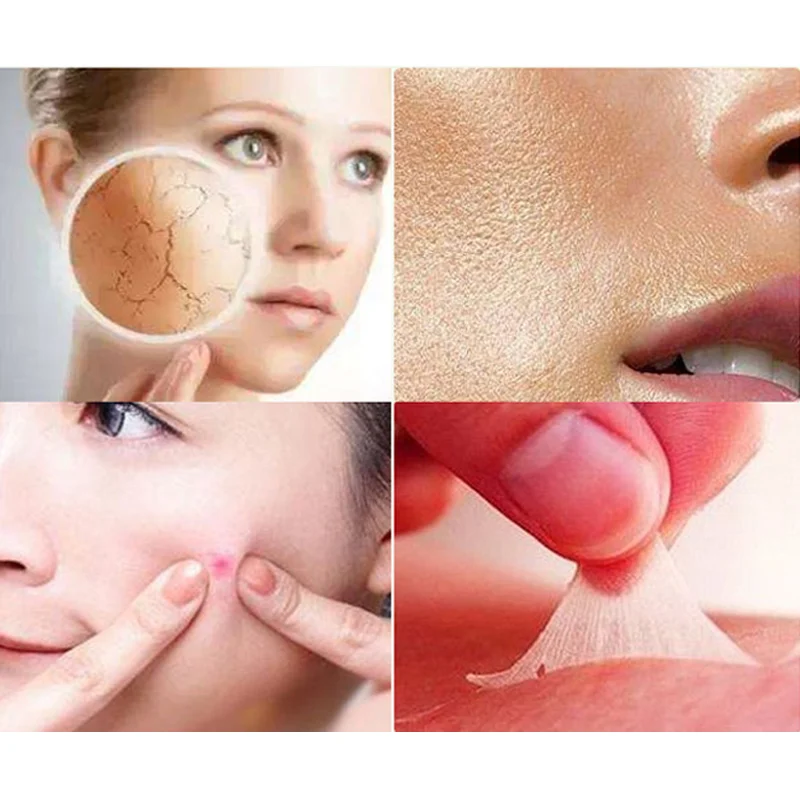 13 мл женский концентрированный алоэ гель от акне крем маска для сна увлажняющая