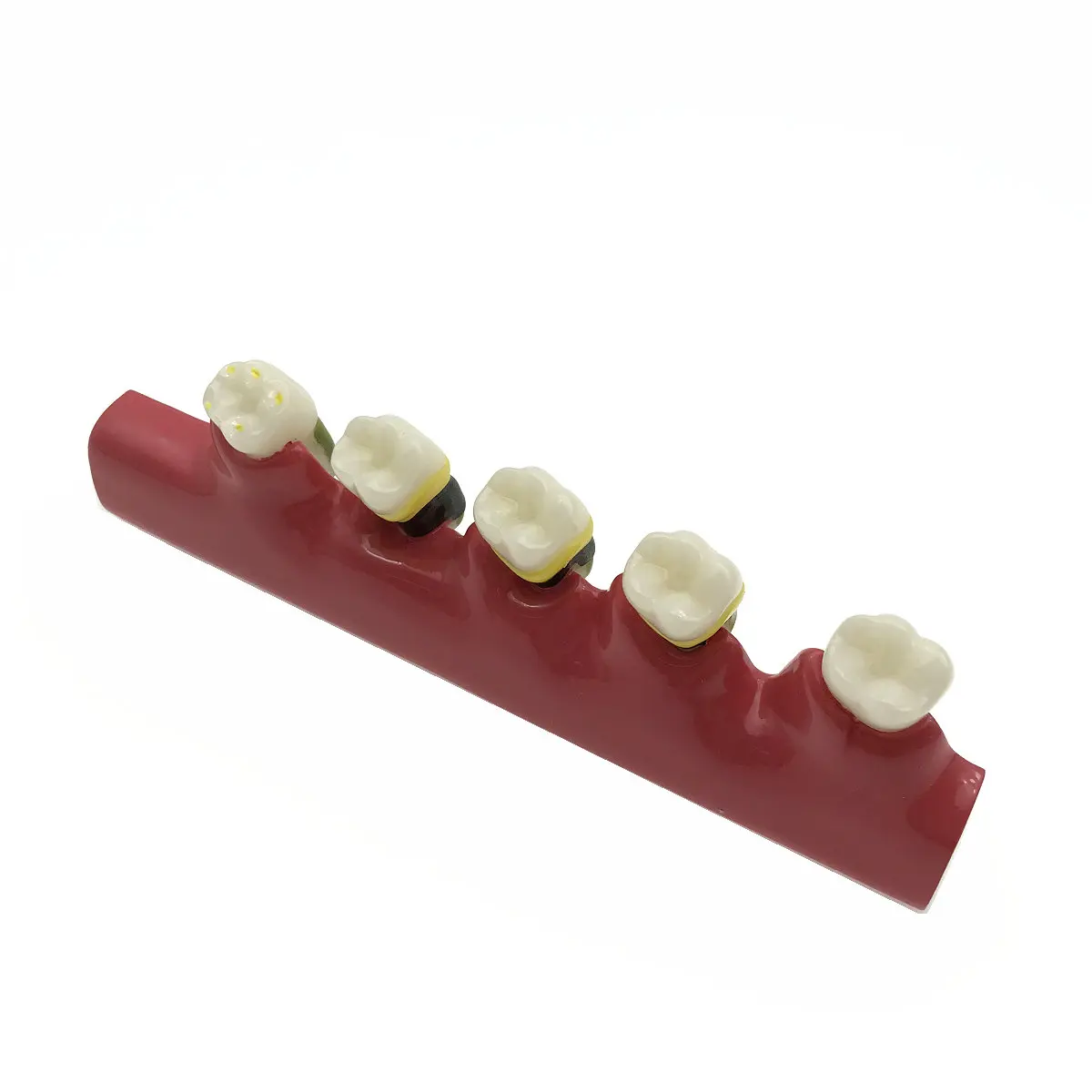 Стоматологический периодонтальный болезни разбирают зуб Typodont модель|model craft|model