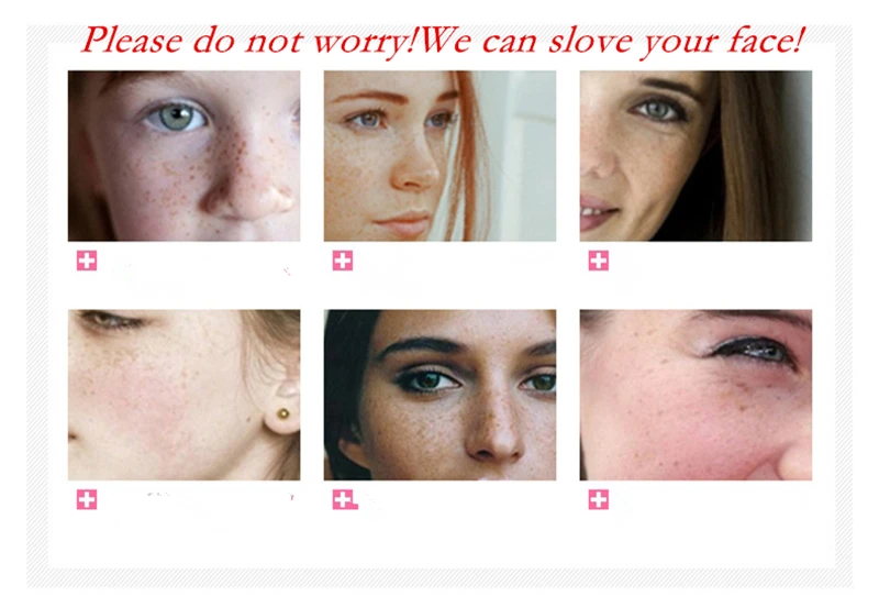 2 пакета (ов) чистые травяные для отбеливания веснушек мягкий уход за кожей лица