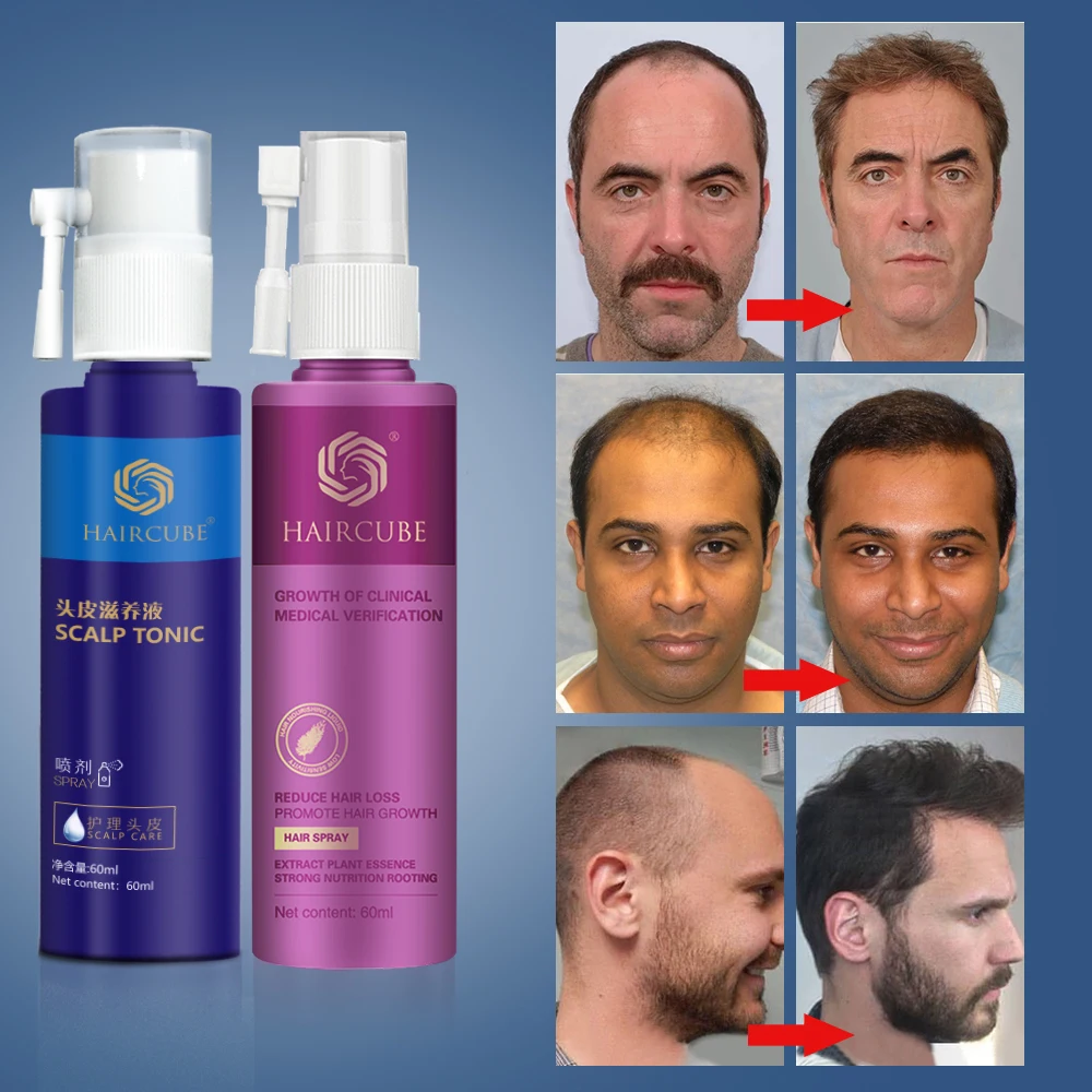 

HAIRCUBE Hair Growth Serum Oil Magic Fast Hair Growth Dense Anti Loss Treatment Essence Liquid Hair Growth Tools Hair Care