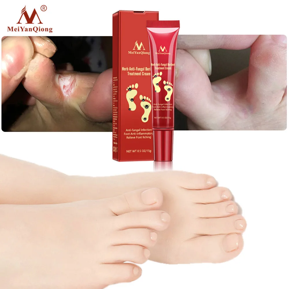 Foot Odor Remove Ointment Antifungal Cream Tinea PedisAnti-Itching Professional Pedicure File Tools Grinding Feet Skin CareF7.26 | Красота и
