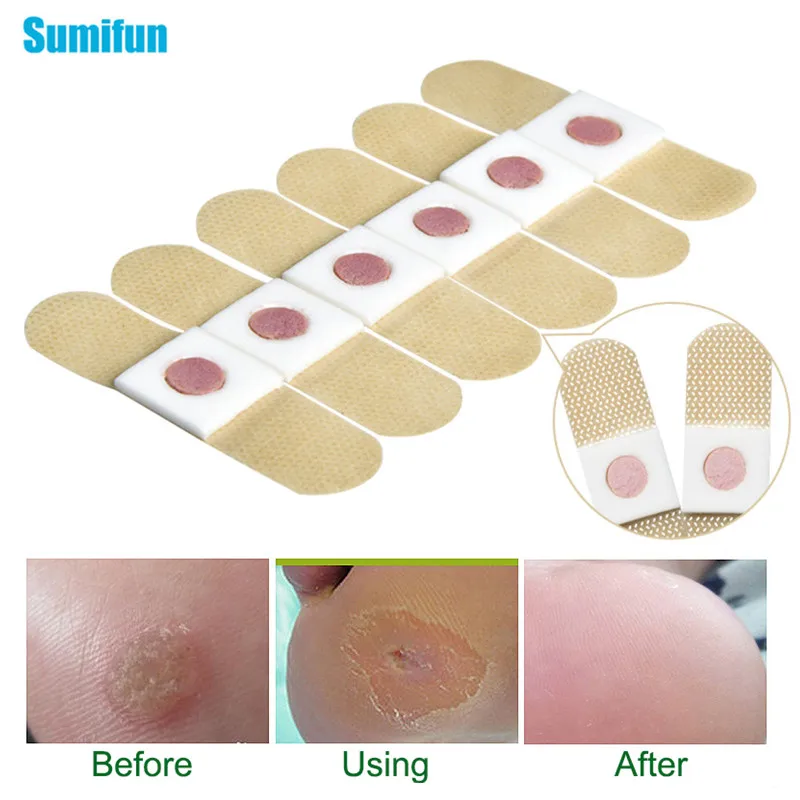 72 шт. медицинский пластырь для ухода за ногами удаления мозолей подошвенные