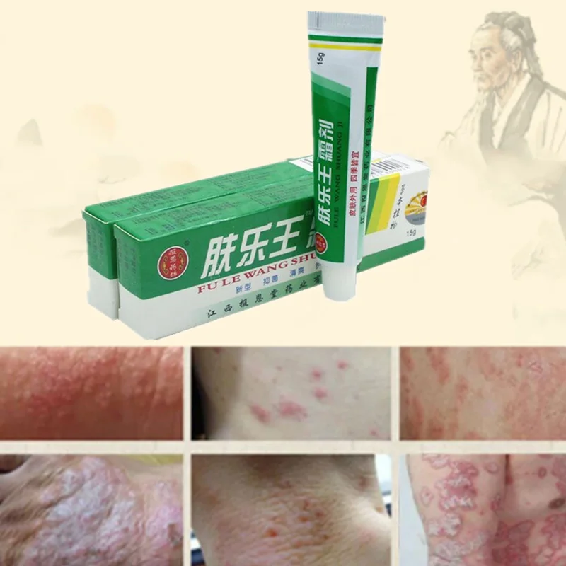 

Herbal Skin Psoriasis Cream Dermatitis Eczematoid Eczema Ointment Treatment Psoriasis Cream15g Body Cream Antipruritic Skin Care