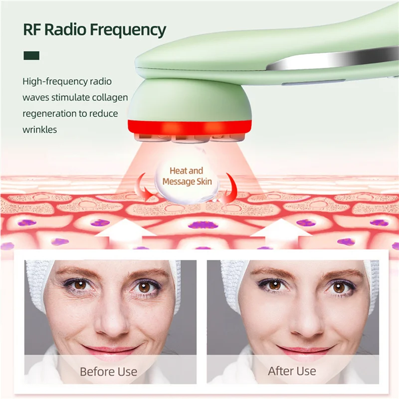 Beste Eyin Ems Microstroom Rf Ro Frequentie Facial Lifting Schoonheid Apparaat Ultrasone Infrarood Lichaam Vermagering Huid Draai Massager