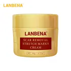 Крем LANBENA для удаления шрамов от акне, Отбеливающее средство для ухода за кожей, 40 г