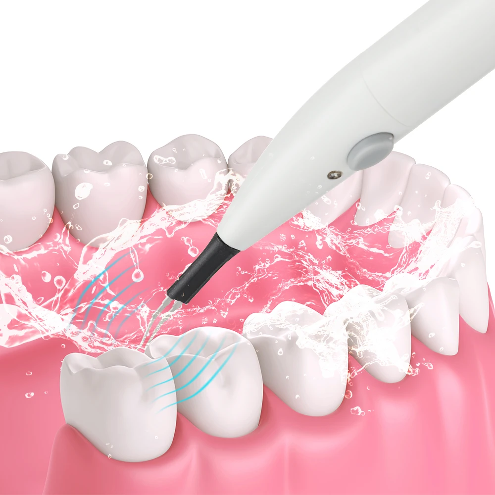 

Dental Gutta Percha Tooth Gum Cutter 4 Tips Endo Gutta Cutter Oral Care Dissolved Breaker Cutter Teeth Whitening