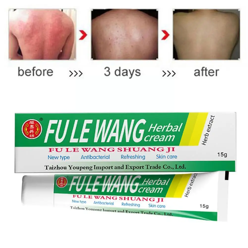 Крем от псориаза для кожи экзематоидная мазь в коробке 1 шт. лечение D6Q5 |