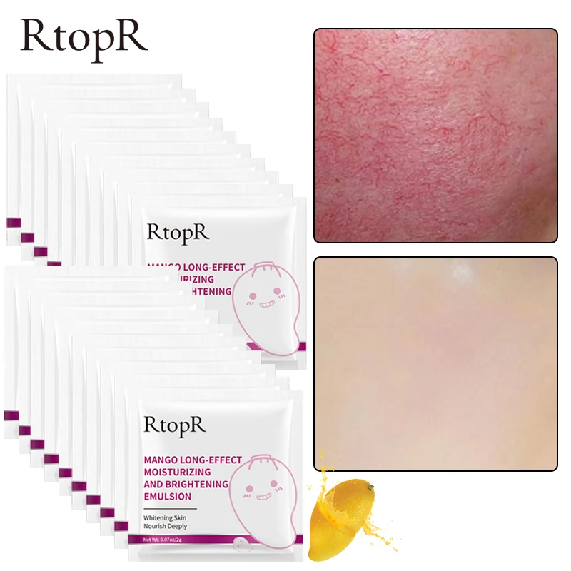 

20 шт манго увлажняющий, антивозрастной Эмульсия анти-морщинистая кожа, отбеливает, укрепляет, угрей Лечение Уход за кожей Питательная, для л...