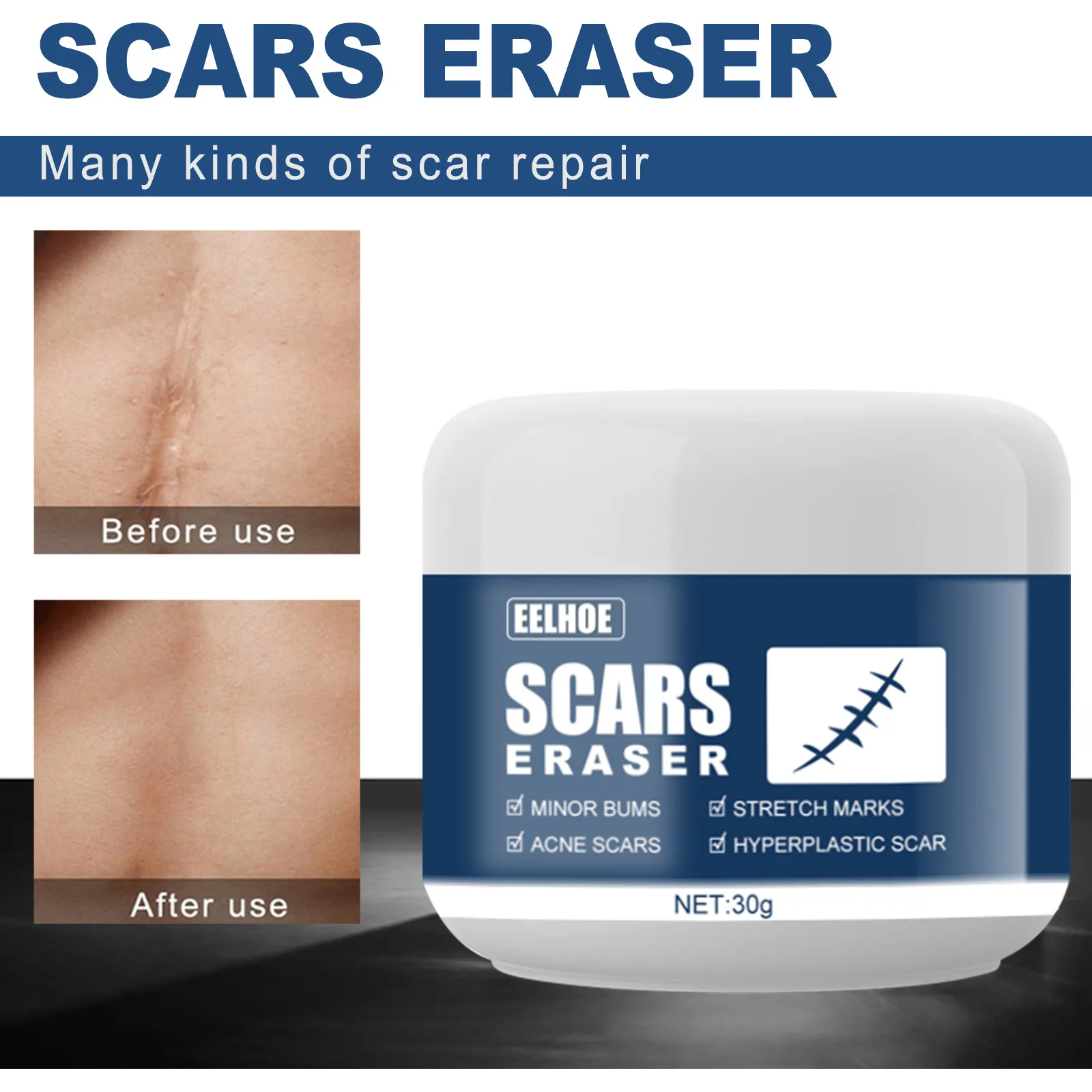 Усовершенствованное лечение для лица и тела старых новых шрамов от порезов