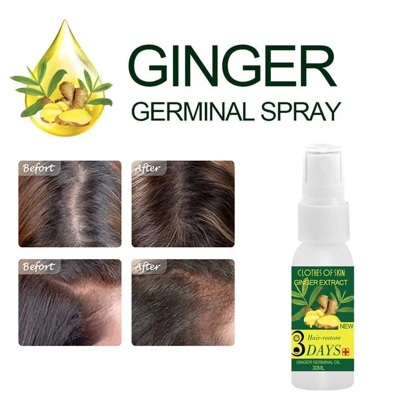 

30ml Ginger Hair Oil Hair Loss Treatment Ginger Hair Care Growth Essence Oil Hair Loss Product Natural With No Side Effects Grow
