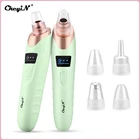 CkeyiN Удаление угрей вакуумные микродермабразия поры, акне Удаление прыщей лица белая головка черная головка всасывания перезаряжаемая 50