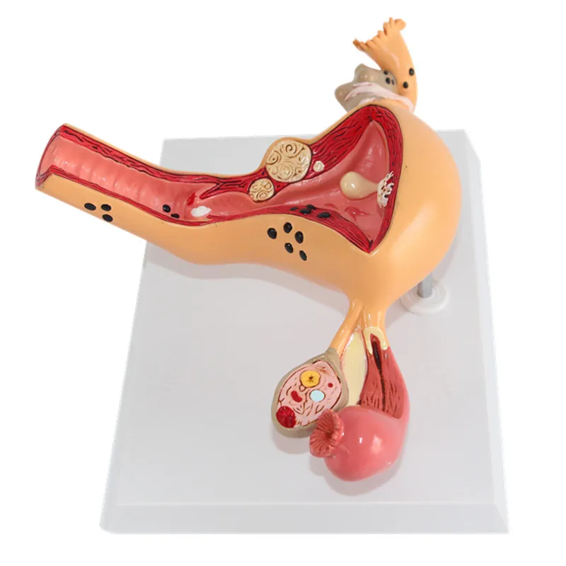 1:1 патологическая матка и яичная анатомическая модель в травмах ортопедическая