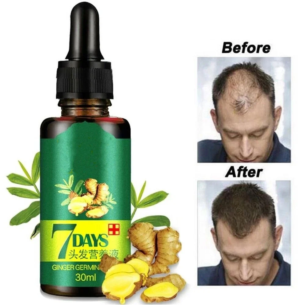 7 дней зародышевый роста волос сывороточная эссенция масла выпадения лечения Для