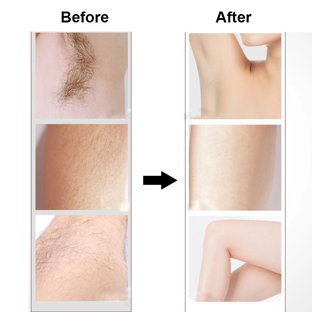 Электрический эпилятор для удаления волос триммер лица женщин женский депилятор