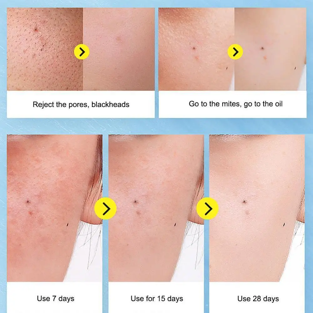 

Cheese Soap Brushed Soap Moisturizing Oil-Control Anti-Acnes Soap Soap Removal Soap Cleansing Mite Soap Salt Sea Q2U7