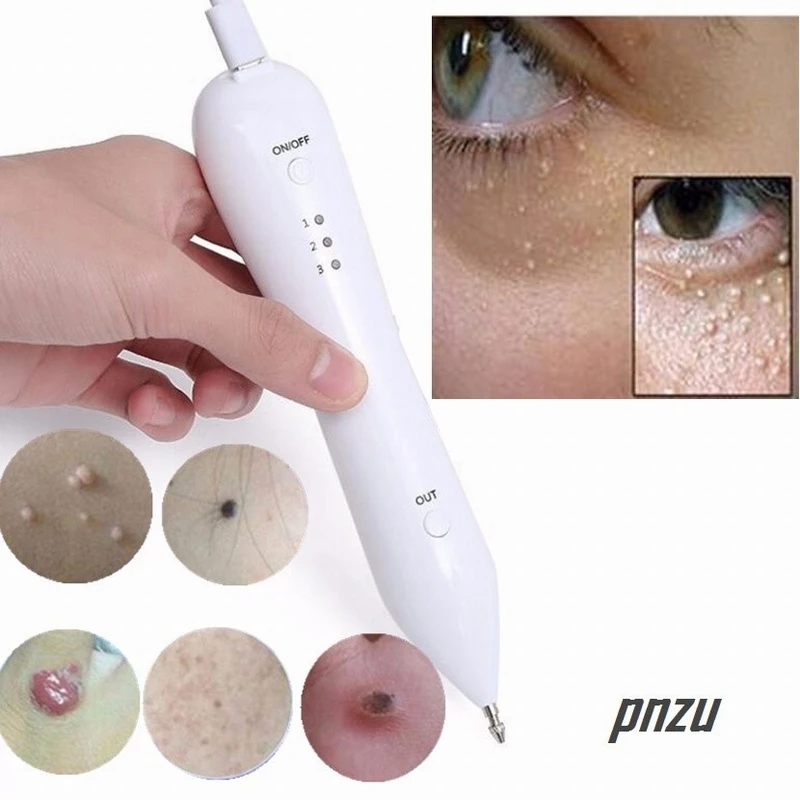 Hotest Skin Tag Remover Pen Pro for Warts Age Spots Tattoo Nevus Dark Spot Women Care Tool High Quality | Красота и здоровье