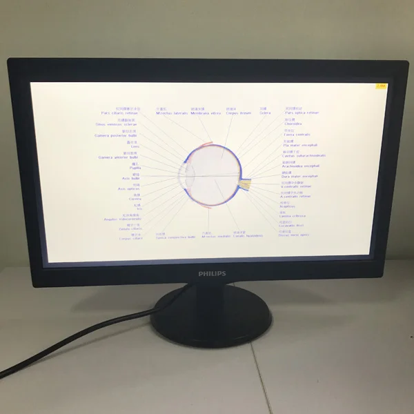 Офтальмологический телефон диагональ экрана 19 дюймов|Детали и аксессуары для
