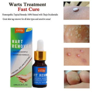 Крем для удаления мозолей, для удаления мозолей, подошвенных бородок, 10 мл, 2019